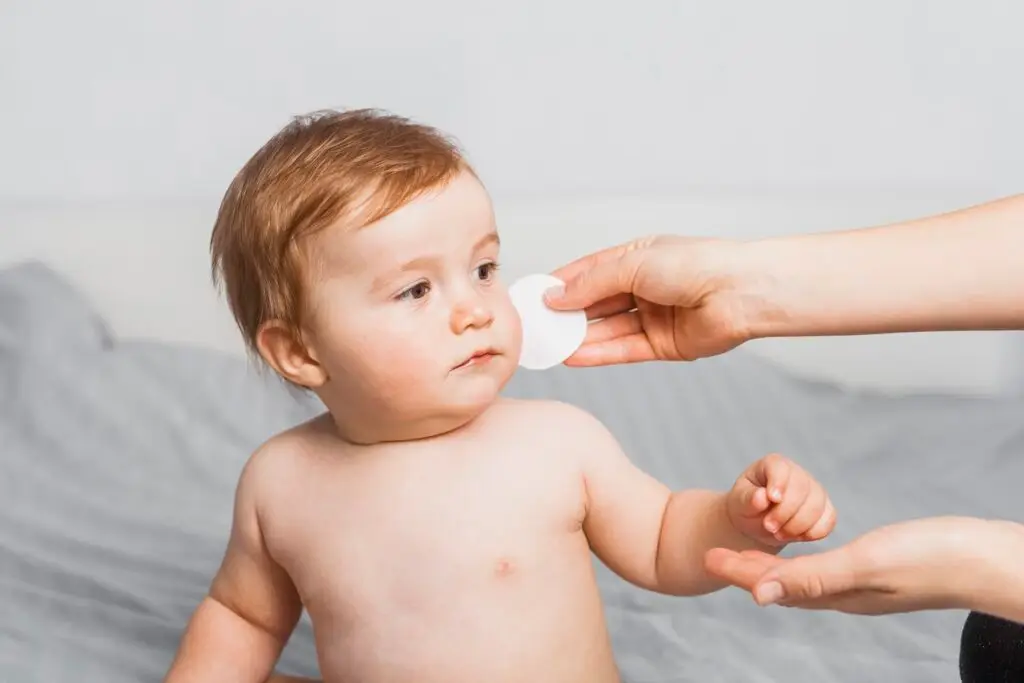 Baby Skin Allergy Home Remedy in Tamil
